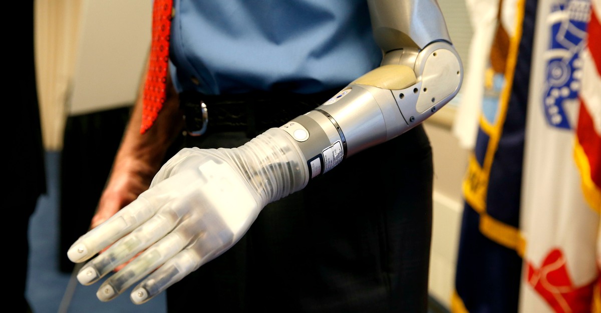 a robotic hand