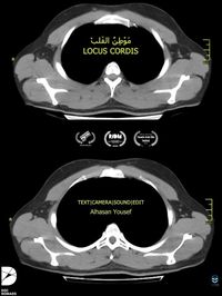 Locus Cordis